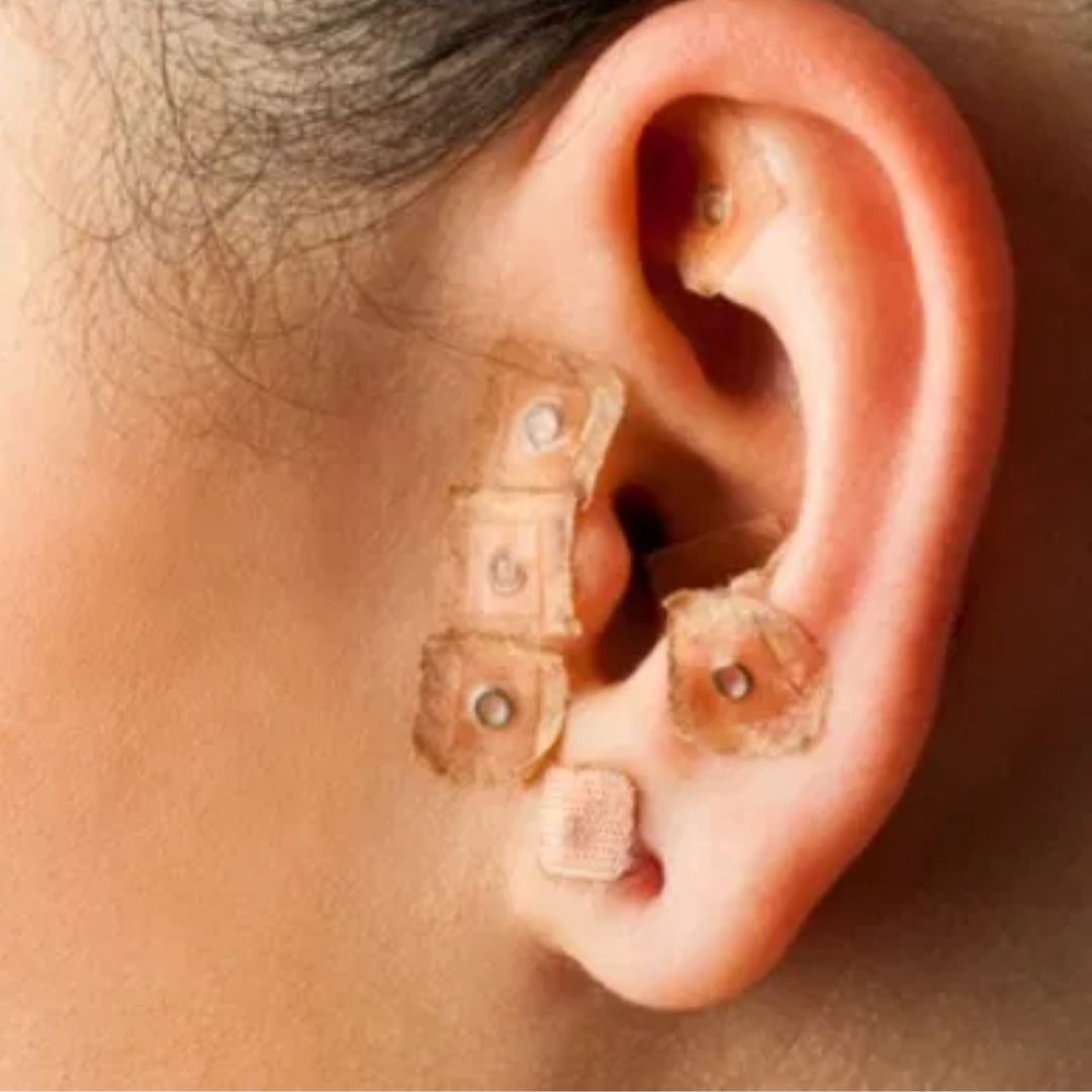 auriculoterapia_2